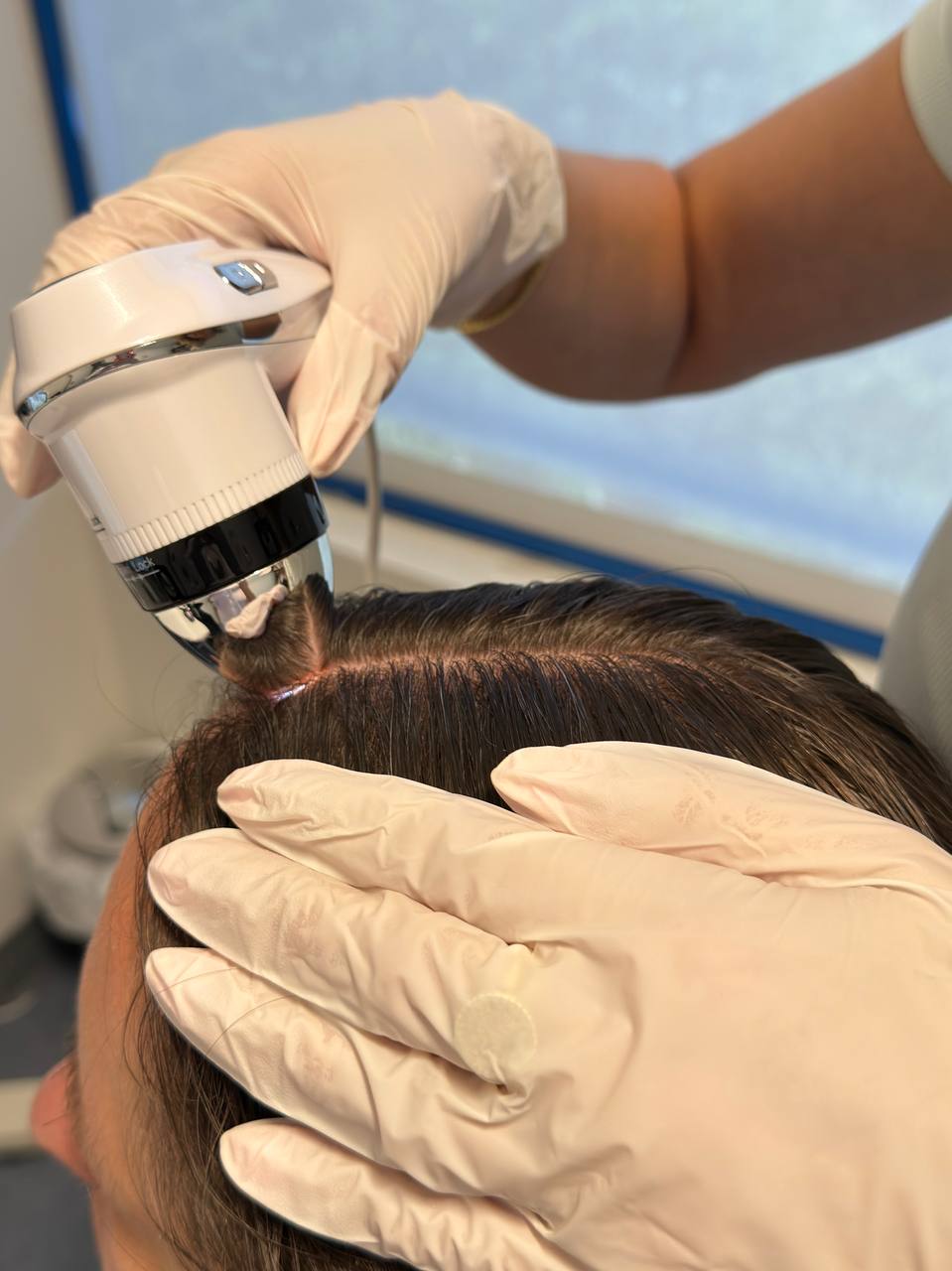 Digital trichoscopy consultation at LAVKA